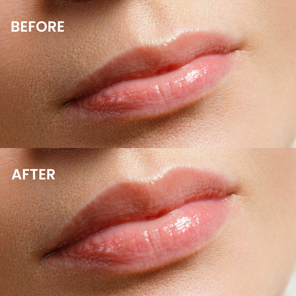 HYPE LIP